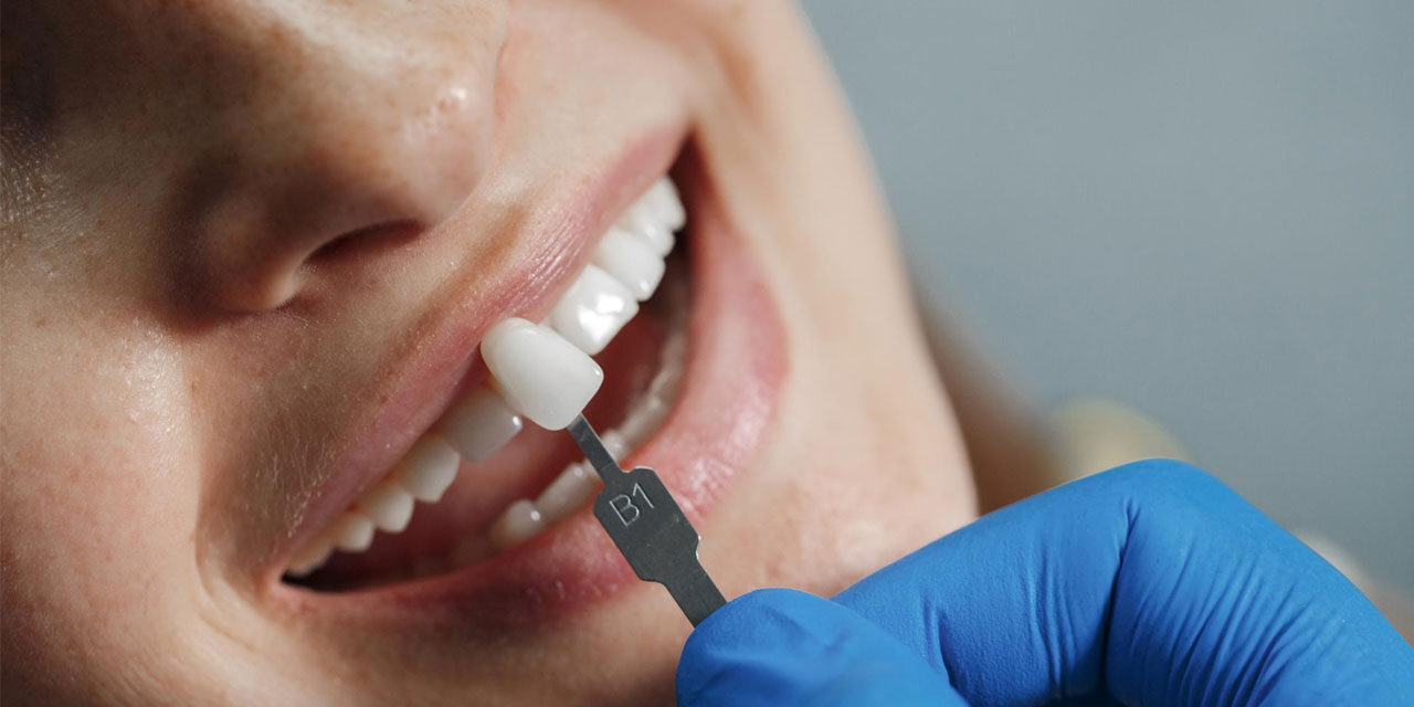 Implantet Dentare