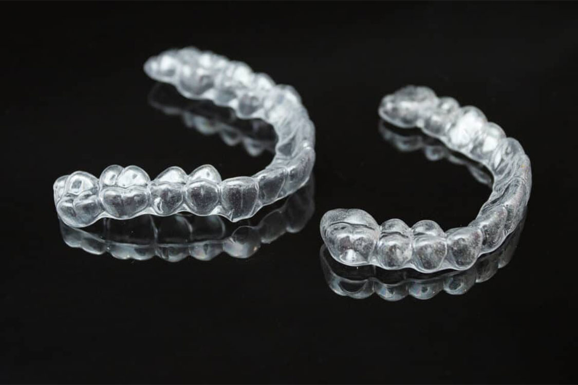 orthodontics-img-003