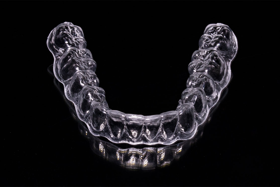 orthodontics-img-004